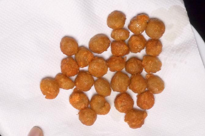 Soya chunks manchurian recipe video   How to make soya manchurian - 94